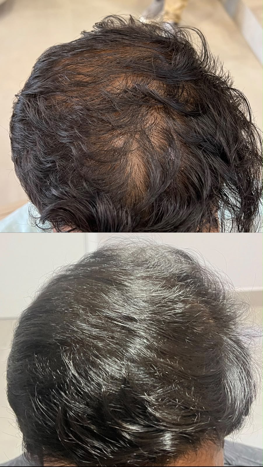 Antes e depois de tratamento capilar 6
