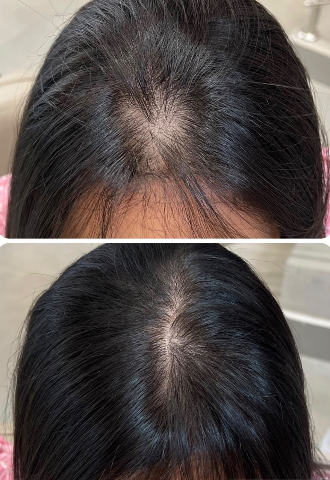 Antes e depois de tratamento capilar 5